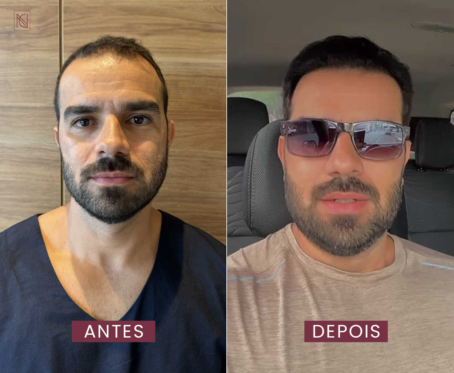 antes 1