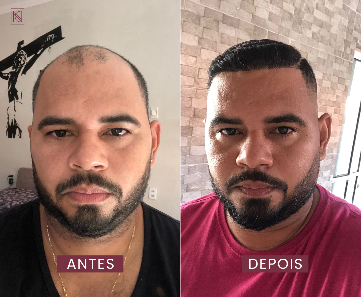 antes 2