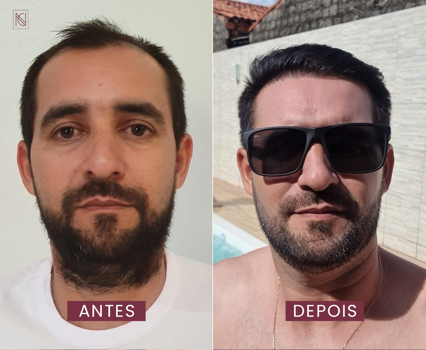 antes 4